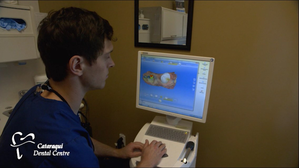 Man working on a CEREC Machine